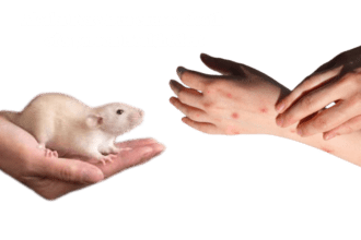 Alaska Pox virus caused death of a person Health Alert