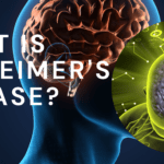 What is Alzheimer's Disease?