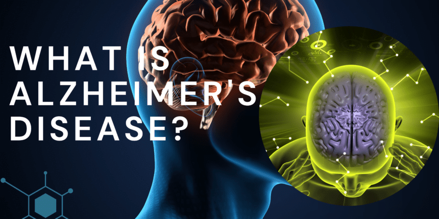 What is Alzheimer's Disease?