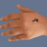 Mosquito on a hand causing West Nile Virus-IWWB NEWS